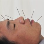 Sennik Akupunktura