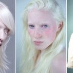 Sennik Albinizm
