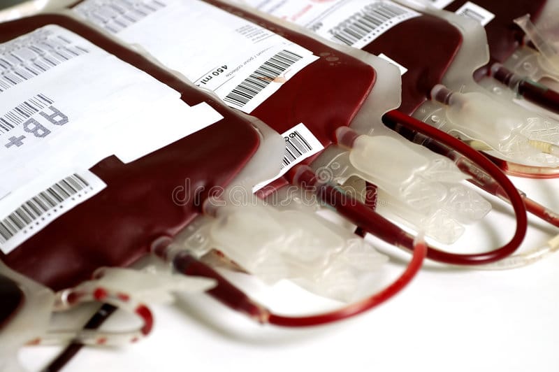 Sennik Transfuzja