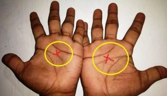 Spiritual Meaning of an X on Palm